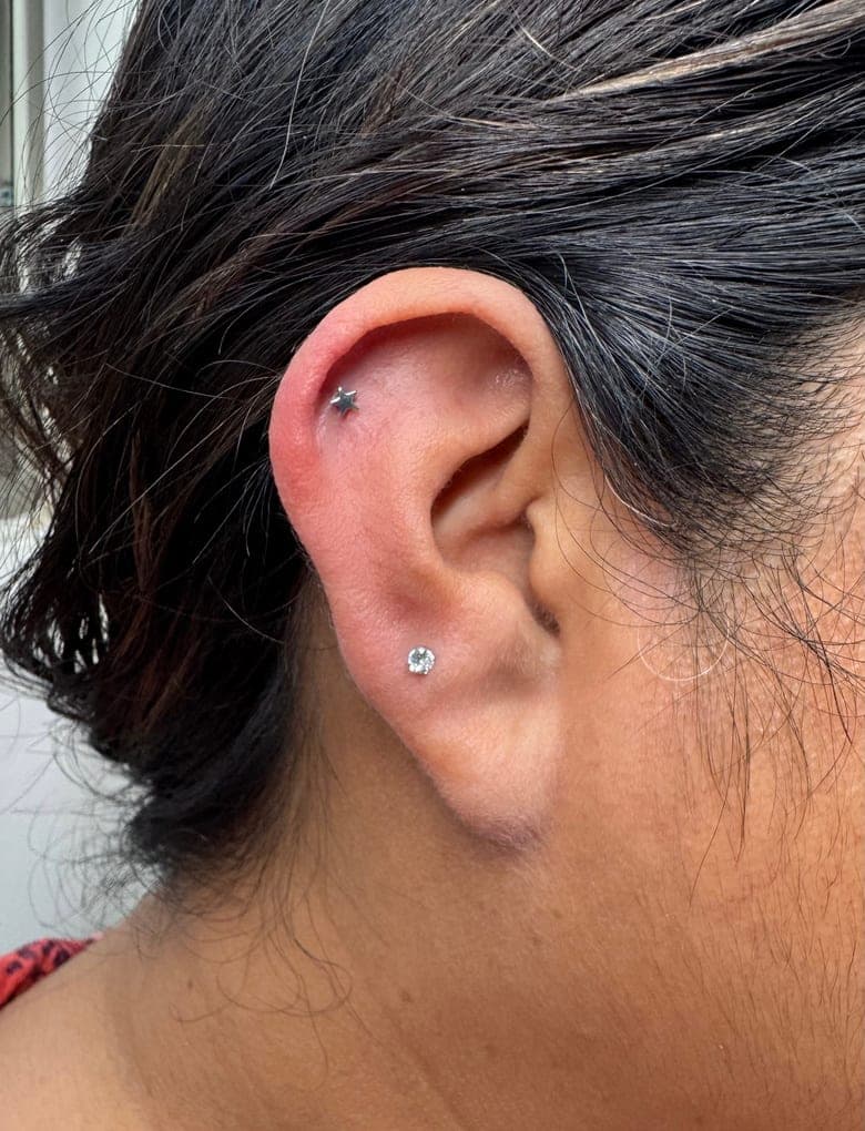Perforaciones en dos zonas con piezas de titanio